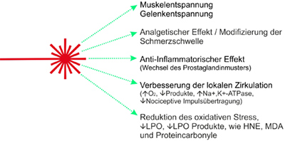 IR Lasertherapie Waermewirkung Kl. 4